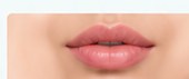 Illustrative lip enhancement image placeholder