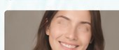 Illustrative smile-line treatment image placeholder
