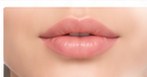 Lip enhancement aesthetic reference
